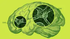 ilustración de un cerebro en donde se señalan las microglías 