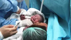 birth