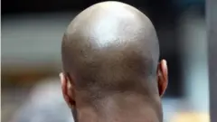 የመላጣ ሰው ጭንቅላት ከጀርባ