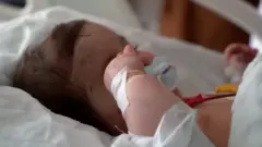 ఆరు నెలల పసిపాప.. ముఖం నిండా గాయాలే