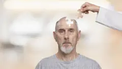 homem com o cerebro em pedacos