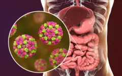 norovirus
