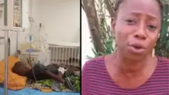 Small pikin intestine lost 