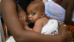 ጡት የሚጠባ ሕጻን 