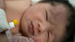 지진 잔해서 구조된 신생아
