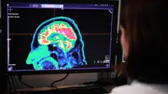 Radiografía de un cerebro.