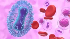 ਐੱਮ ਪੌਕਸ