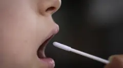 Otvorena usta i štapić za uzimanje brisa