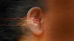 శబ్ద కాలుష్యం, ఆరోగ్యం