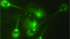 Parasita descoberto