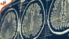 استنبات خلايا دماغ من أعضاء الجسم