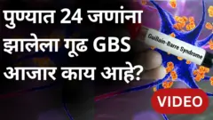 गीयन बारे सिंड्रोम काय आहे? पुण्यात त्याचे इतके रुग्ण कसे?