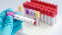 Àyẹ̀wò tó fìdí HIV múlẹ̀