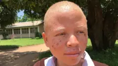 Joyce alikataliwa na baba yake kwa sababu ya kuwa mlemavu wa ngozi