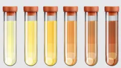 የሽንት ቀለማት ዓይነቶች