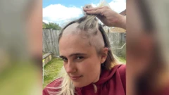 Phoebe Tesoriere no jardim, mostrando a queda do seu cabelo