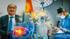 Боор алмаштыруу опреациясы кыргыз медицинасындагы жаңы баскыч болуп калды