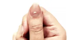 ਸੰਕੇਤਕ ਤਸਵੀਰ