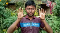 వేలు ముద్రలు లేని వ్యక్తి