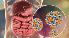 Hepatit Hepatit B, Hepatit C, Hepatit A, hepatit xəstəlikləri 