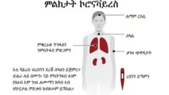 ስእላዊ መግለጺ ኮሮናቫይረስ