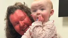 Una mujer con la cara rojiza sostiene a una bebé