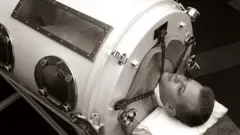 celicna pluca deceija paraliza