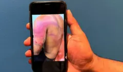 A tara Ravi ahụhụ abalị iri na isii