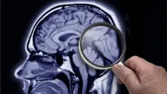 Brain
