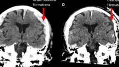 የአንጎል ስካን