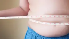 obez çocuk