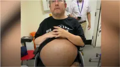 Voren Higs pre operacije