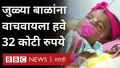 बडोद्याच्या जुळ्यांना एका दुर्मीळ आजाराने ग्रासलं आहे.
