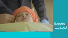 الطفلة السورية شام.. بتر ساقيها بعد نقلها إلى الإمارات بسبب متلازمة "هرس الأطراف"