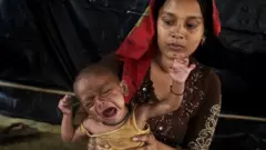 Niño con desnutrición