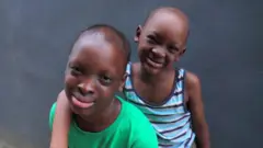 Ectodermal Dysplasia