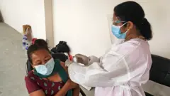 खोप