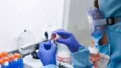 ما هو الدور الذي تلعبه الجينات في الحد من انتشار فيروس كورونا؟