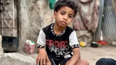 بدر در راه بازگشت از مدرسه، در جریان یک گلوله‌باران، قسمتی از پای راستش را دست داد