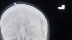 th