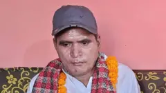 दीपक जैसी तिम्सिना