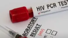HIV
