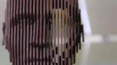 الخرف لا يعني النسيان فقط، بل هو متلازمة تتسم بتدهور تدريجي للذاكرة والتفكير والقدرة على التوجّه والفهم