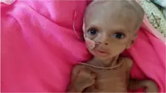 Ethiopian baby