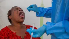 Woman wey dey do Covid-19 test wit her mouth wide open