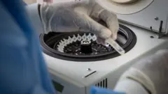 Umukozi wa RBC ariko gupima coronavirus
