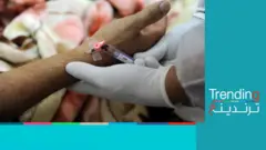 المستشفيات الجزائرية في "أزمة أوكسجين" بسبب ارتفاع الإصابات