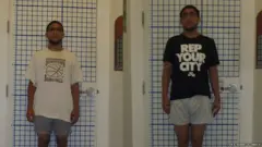 ਸਰਜਰੀ