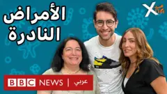 صورة من حلقة بي بي سي اكسترا عن الأمراض النادرة