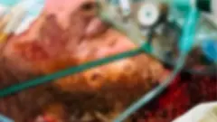 ایراننوموړی زیاتوي ځان ته د اور ورته کولو لامل یې هغو بې عدالتیو ته د رسنیو پام اړول و، چې له لسیزو راهیسې یې پلار ورسره مخامخ دی.